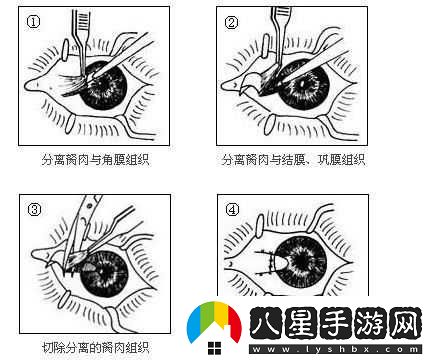 獲得超級(jí)胬肉系統(tǒng)怎么辦